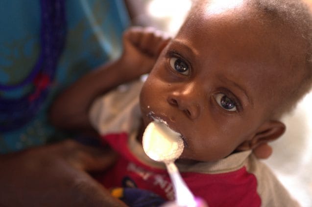 Location: Ondjiva, Cunene Angola Tuhafenis Story He has a big name for such a little boy. Hes called Tuhafeni. Tuhafeni is 18 months old but looks much smaller because severe acute malnutrition has left his tiny body wasted. Tuhafeni could die. Tuhafeni arrived at the Chiulo health post 15 days ago with his worried grandmother, Ines. His condition remains critical. The small rural outpost near their home didnt have the resources to help when Tuhafeni became sick with malaria and pneumonia. Grandmother Ines travelled more than 50 kms here when her grandson became sick. They begged a ride on a truck for the first 20 kms, then convinced a taxi driver to taken them the rest of the way. Their journey is sadly becoming more commonplace in Angola where 95,977 children in some of the most affected provinces are suffering from severe acute malnutrition. And its why UNICEF is putting special emphasis on reinforcing positive community activities to ensure that children at risk, like Tuhafeni, get referred to health centres before its too late. Tuhafenis district has been particularly hard hit by the recurrent cycles of droughts and floods that characterize El Nino. This has seriously affected food supply and rates of malnutrition have doubled over the last six months. As soon as Tuhafeni reachesthe clinic, he is admitted to the ward where the most serious cases go. Then its a race against time and an exercise in patience. Bringing a child, like Tuhafeni, back from severe acute malnutrition requires care and skill. Too slowly, and a child could be lost. Too quickly, and a childs body could go into shock. Tuhafenis immune system is already more susceptible to infection and he has lose the ability to regulate his body temperature. Like other children suffering from severe acute malnutrition, he will use every reserve, including fat and muscle to keep his tiny heart beating. Then one by one his tiny organs will shut down. Thats unless